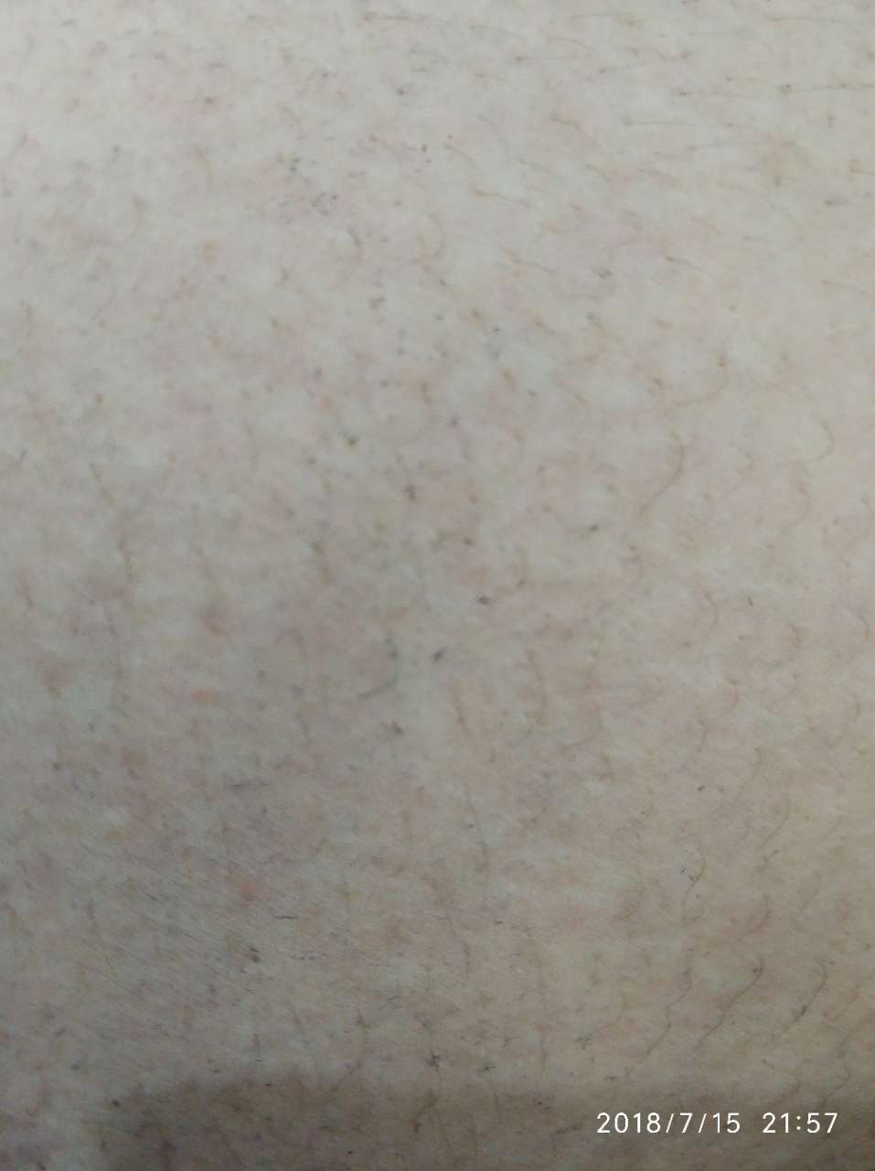 20180716_29219_1531727061062.jpg