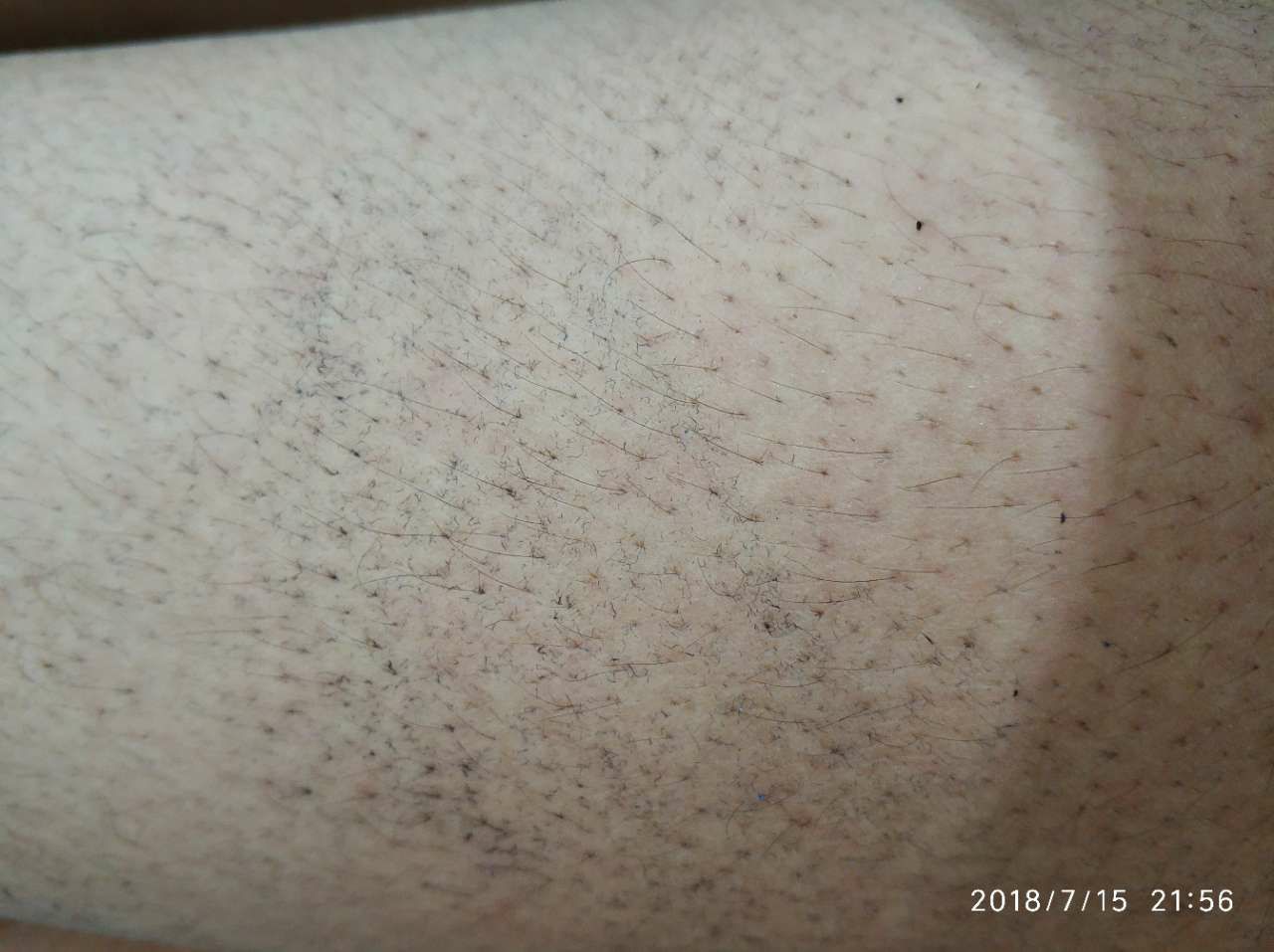 20180823_29219_1534991273000.jpg