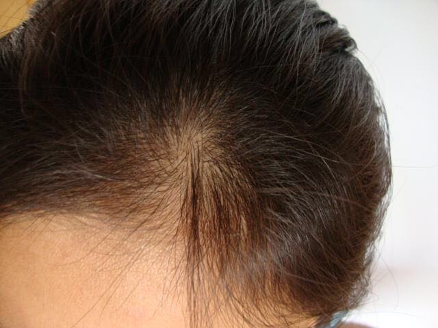 front1_FkgKMHfyArB858pcTLGd9PM_KCwe.jpg