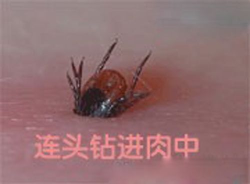 front2_0_FlyAbzchp6B_IQERcBtLiJCw2goC.jpg
