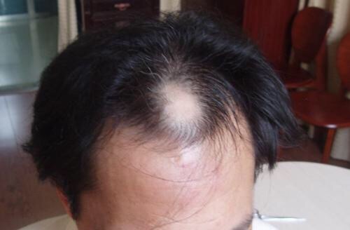 front1_0_ForRMrHXIhpMzaSn-eCOpoqB3dw4.1606815339.jpg