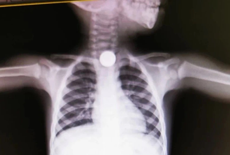 front1_0_FjvxWIA4XdW0ptqmNm4KV1ia8nbt.1626394875.jpg