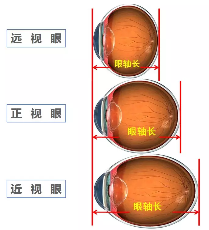 近视防控08.png
