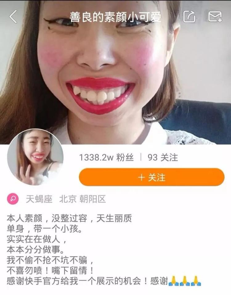 嘟嘟姐被封了,长的与众不同有错吗,你们怎么看?